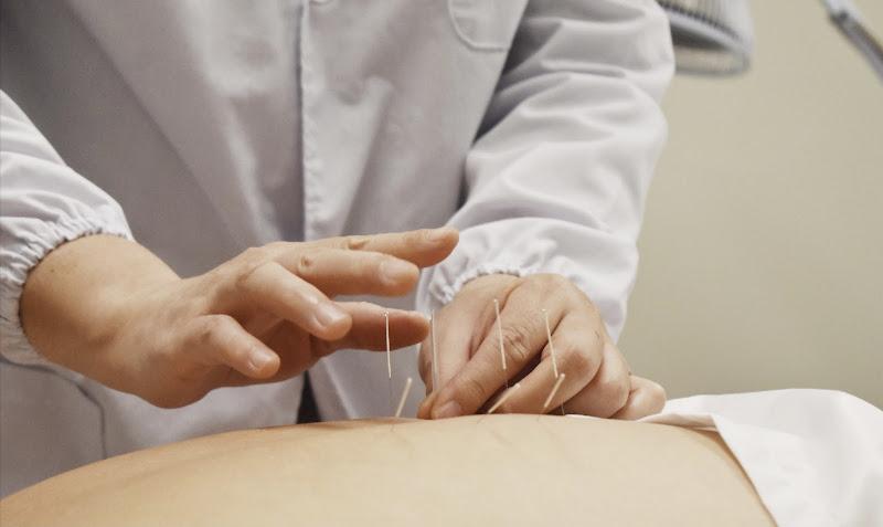 Li Acupuncture and Herbs - Janny Li clinic